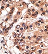 AP13157PU-N - MLLT3 / AF9