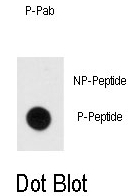AP12968PU-N - Myelin Basic Protein
