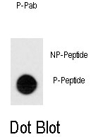 AP12973PU-N - CD202b / TEK