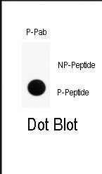 AP13025PU-N - SLC29A1 / ENT1