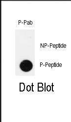 AP13027PU-N - Insulin promoter factor 1