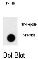 AP12983PU-N - Prolactin / PRL