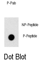 AP12985PU-N - ZBTB16