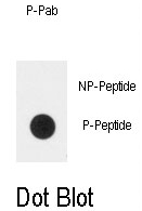 AP12994PU-N - PLXND1