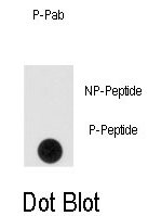 AP12995PU-N - Sprouty homolog 4 / SPRY4
