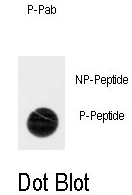 AP12997PU-N - TNK2 / ACK1