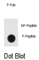 AP12999PU-N - Neuron specific enolase