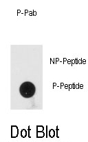 AP13003PU-N - PRKRA / PACT