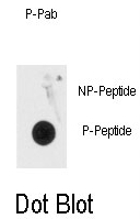 AP13005PU-N - MeCP2