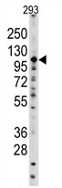 AP11501PU-N - Sal-like protein 4 (SALL4)