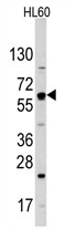 AP11502PU-N - GLUT2 / SLC2A2