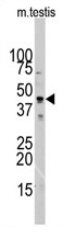 AP11505PU-N - alpha 1 cardiac muscle Actin / ACTC1