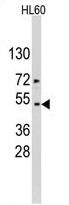 AP11506PU-N - alpha 1 cardiac muscle Actin / ACTC1