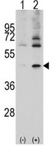 AP11506PU-N - alpha 1 cardiac muscle Actin / ACTC1