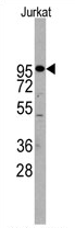 AP11508PU-N - CD156b / ADAM17