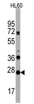 AP11514PU-N - CD3 gamma chain
