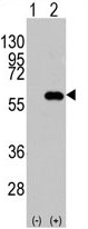 AP11516PU-N - CD4