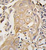 AP11516PU-N - CD4