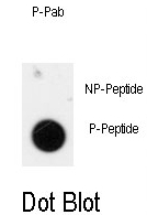 AP13013PU-N - Anthrax toxin receptor 1 / ANTXR1