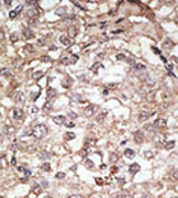 AP11524PU-N - CD281 / TLR1