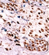 AP12647PU-N - HGF receptor