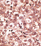AP11536PU-N - CD286 / TLR6