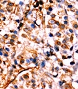 AP12653PU-N - RELA / NF-kB p65