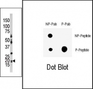 AP12664PU-N - CDKN1A / p21WAF1