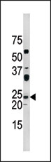 AP12665PU-N - CDKN1A / p21WAF1
