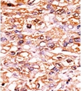 AP12667PU-N - CDKN1B / KIP1