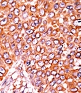 AP12668PU-N - CDKN1B / KIP1