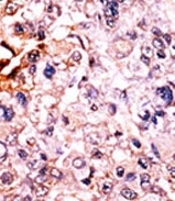 AP12669PU-N - CDKN1B / KIP1