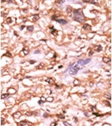 AP12678PU-N - TP53 / p53