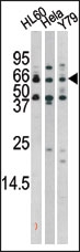 AP12684PU-N - RAD9A
