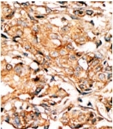 AP12685PU-N - RAD9A