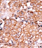 AP12686PU-N - RAD9A