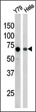 AP12691PU-N - RAD9A