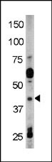 AP12692PU-N - RAD9A