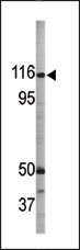 AP12693PU-N - RBL1