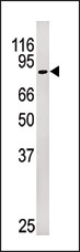 AP12694PU-N - Retinoblastoma-associated protein / RB1