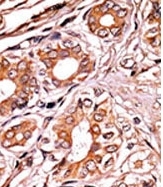 AP12694PU-N - Retinoblastoma-associated protein / RB1