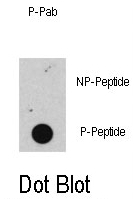 AP12695PU-N - Retinoblastoma-associated protein / RB1