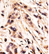 AP12695PU-N - Retinoblastoma-associated protein / RB1