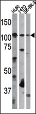 AP12696PU-N - Retinoblastoma-associated protein / RB1