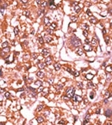 AP12696PU-N - Retinoblastoma-associated protein / RB1