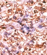 AP12698PU-N - Retinoblastoma-associated protein / RB1