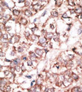 AP11552PU-N - Dickkopf-2 (DKK2)
