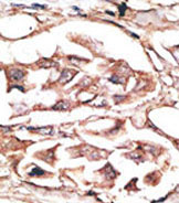 AP11553PU-N - Dickkopf-2 (DKK2)