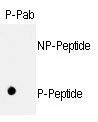 AP12701PU-N - Retinoblastoma-associated protein / RB1