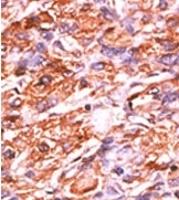 AP12701PU-N - Retinoblastoma-associated protein / RB1